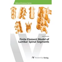 Picture of Finite Element Model of Lumbar Spinal Segments