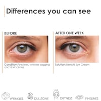 Picture of Berrichi Eye Cream For Dark Circles & Wrinkles, 15Ml