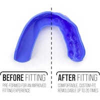 Picture of Sisu Sports 3D Mouth Guard, 2.0mm